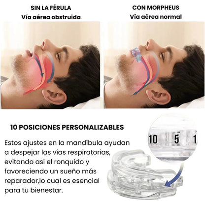 OFERTA 2X1 | Morpheus - Férula Bucal Antirronquidos